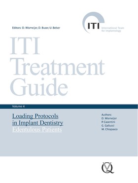 Loading Protocols in Implant Dentistry