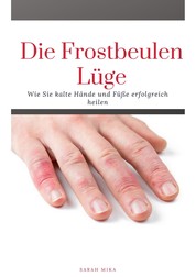 Die Frostbeulen Lüge - Wie Sie kalte Füße und Hände erfolgreich heilen