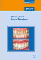 Martin Kelleher: Dental Bleaching 