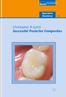 Christopher D. Lynch: Successful Posterior Composites 