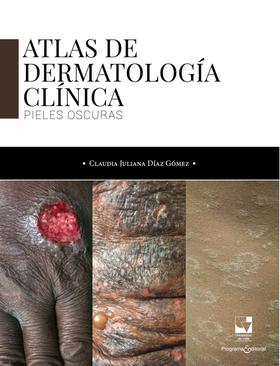 Atlas de dermatología clínica