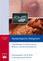 Gynäkologische Malignome - Tumortherapie und Nachsorge bei Mamma- und Genitalmalignomen