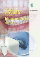 José Amengual Lorenzo: Atlas terapéutico de blanqueamiento dental 
