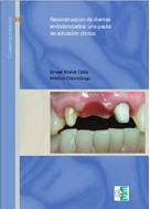 Ernest Mallat Callís: Reconstrucción de dientes endodonciados 