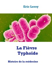 La Fièvre Typhoïde - Histoire de la médecine