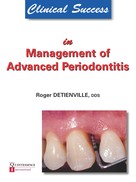 Roger Detienville: Clinical Success in Management of Advanced Periodontitis 