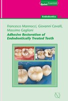 Francesco Mannocci: Adhesive Restoration of Endodontically Treated Teeth 